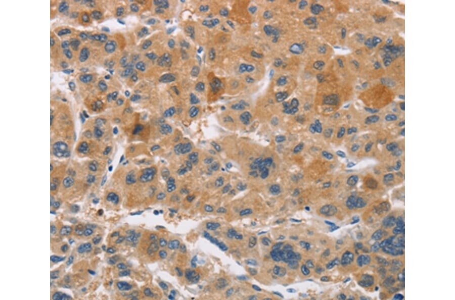 Immunohistochemistry - CYP4A11 Antibody from Signalway Antibody (36391) - Antibodies.com