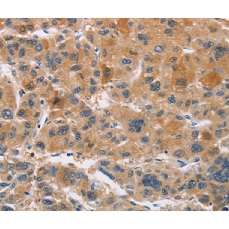 Immunohistochemistry - CYP4A11 Antibody from Signalway Antibody (36391) - Antibodies.com