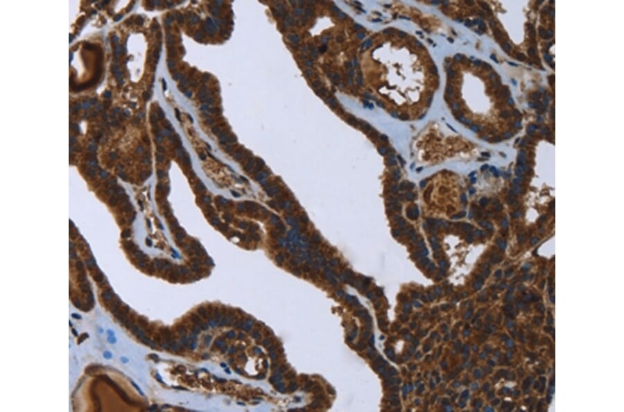 Immunohistochemistry - FASTKD2 Antibody from Signalway Antibody (36470) - Antibodies.com