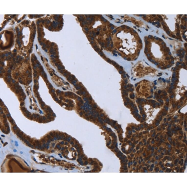 Immunohistochemistry - FASTKD2 Antibody from Signalway Antibody (36470) - Antibodies.com