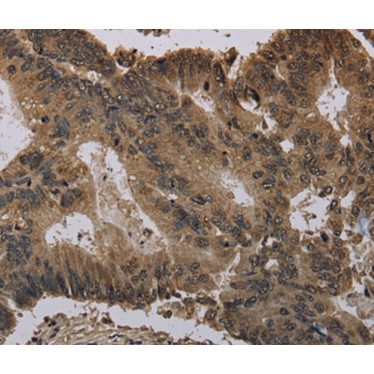 Immunohistochemistry - HIST4H4 Antibody from Signalway Antibody (36519) - Antibodies.com
