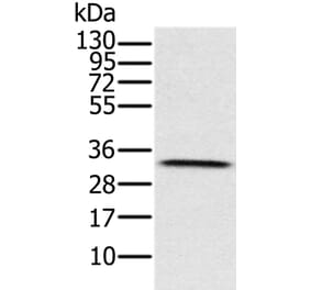 HSD17B8 Antibody from Signalway Antibody (36528) - Antibodies.com