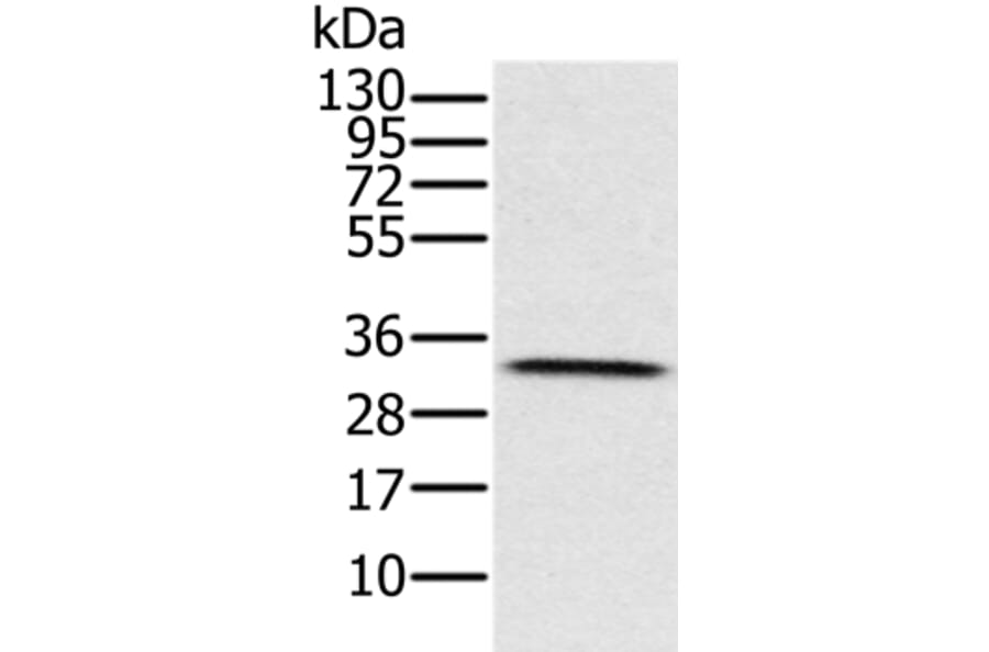 HSD17B8 Antibody from Signalway Antibody (36528) - Antibodies.com