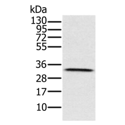 HSD17B8 Antibody from Signalway Antibody (36528) - Antibodies.com