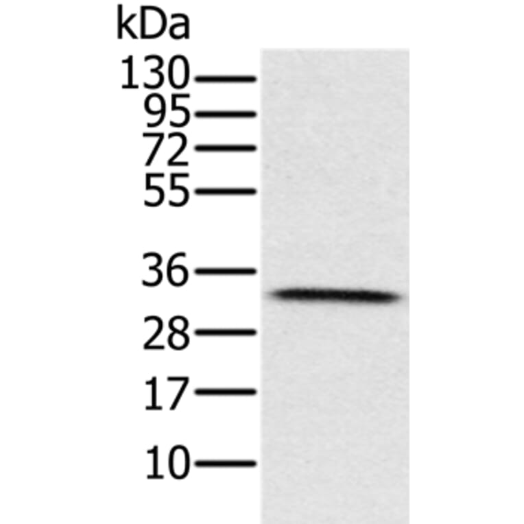 HSD17B8 Antibody from Signalway Antibody (36528) - Antibodies.com