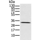 HSD17B8 Antibody from Signalway Antibody (36528) - Antibodies.com