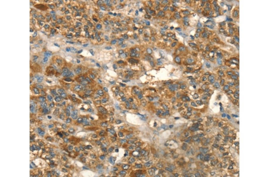 Immunohistochemistry - HSD17B8 Antibody from Signalway Antibody (36528) - Antibodies.com