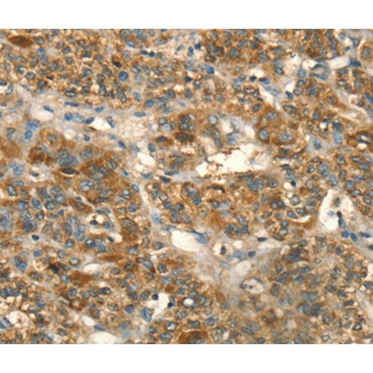 Immunohistochemistry - HSD17B8 Antibody from Signalway Antibody (36528) - Antibodies.com