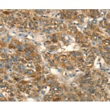 Immunohistochemistry - HSD17B8 Antibody from Signalway Antibody (36528) - Antibodies.com