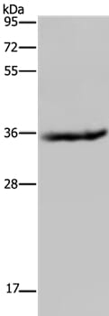 Gel: 10% SDS-PAGE Lysates (from left to right): Mouse liver tissue Amount of lysate: 40ug per lane Primary antibody: 1/200 dilution Secondary antibody dilution: 1/8000 Exposure time: 1 minute