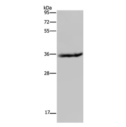 HSD17B6 Antibody from Signalway Antibody (36533) - Antibodies.com