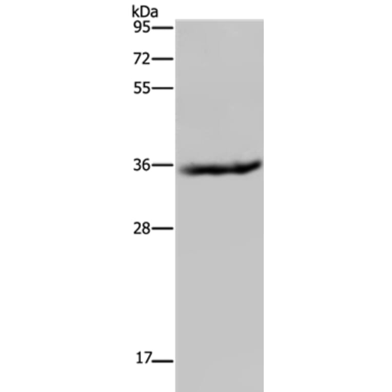 HSD17B6 Antibody from Signalway Antibody (36533) - Antibodies.com