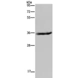 HSD17B6 Antibody from Signalway Antibody (36533) - Antibodies.com