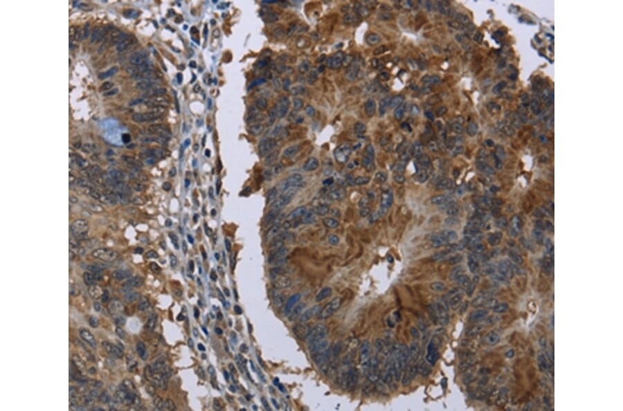 Immunohistochemistry - HSD17B6 Antibody from Signalway Antibody (36533) - Antibodies.com