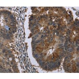 Immunohistochemistry - HSD17B6 Antibody from Signalway Antibody (36533) - Antibodies.com