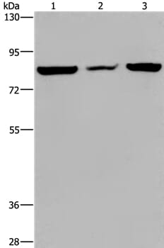 Gel: 6%SDS-PAGE Lysates (from left to right): A549 cell, mouse heart tissue and Hela cell Amount of lysate: 40ug per lane Primary antibody: 1/300 dilution Secondary antibody dilution: 1/8000 Exposure time: 20 seconds