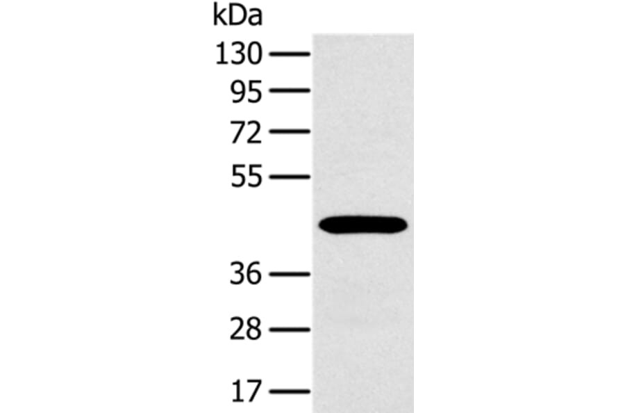 MAGEA10 Antibody from Signalway Antibody (36594) - Antibodies.com