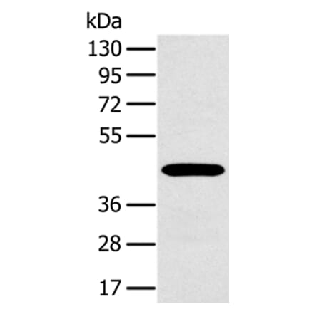 MAGEA10 Antibody from Signalway Antibody (36594) - Antibodies.com