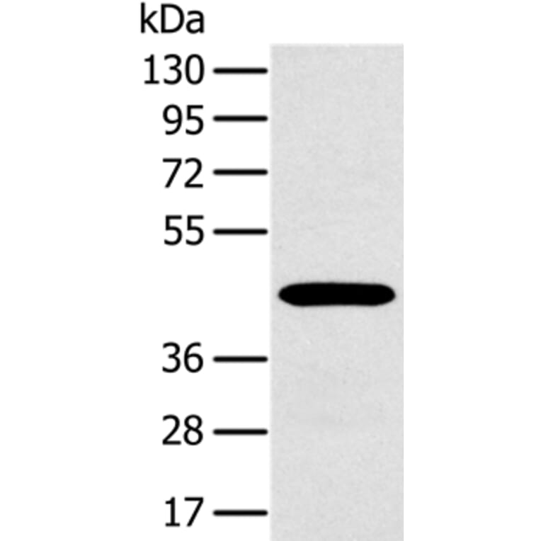 MAGEA10 Antibody from Signalway Antibody (36594) - Antibodies.com