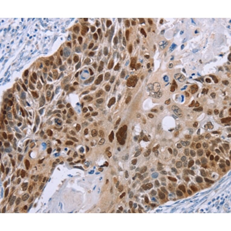Immunohistochemistry - MAGEA10 Antibody from Signalway Antibody (36594) - Antibodies.com