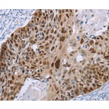 Immunohistochemistry - MAGEA10 Antibody from Signalway Antibody (36594) - Antibodies.com
