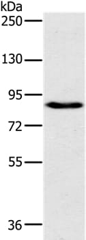 Gel: 6%SDS-PAGE Lysate: 40ug 231 cell Primary antibody: 1/800 dilution Secondary antibody dilution: 1/8000 Exposure time: 10 seconds