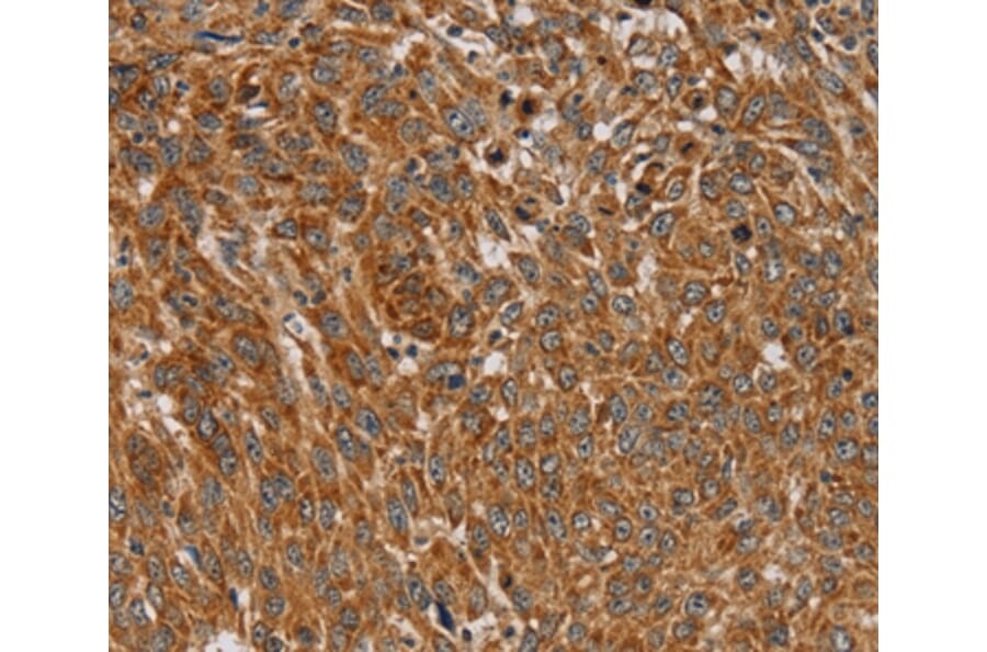 Immunohistochemistry - PLEKHG6 Antibody from Signalway Antibody (36627) - Antibodies.com
