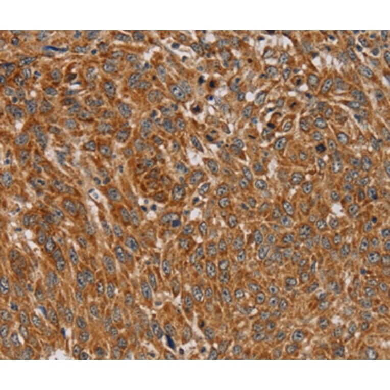 Immunohistochemistry - PLEKHG6 Antibody from Signalway Antibody (36627) - Antibodies.com