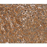 Immunohistochemistry - PLEKHG6 Antibody from Signalway Antibody (36627) - Antibodies.com