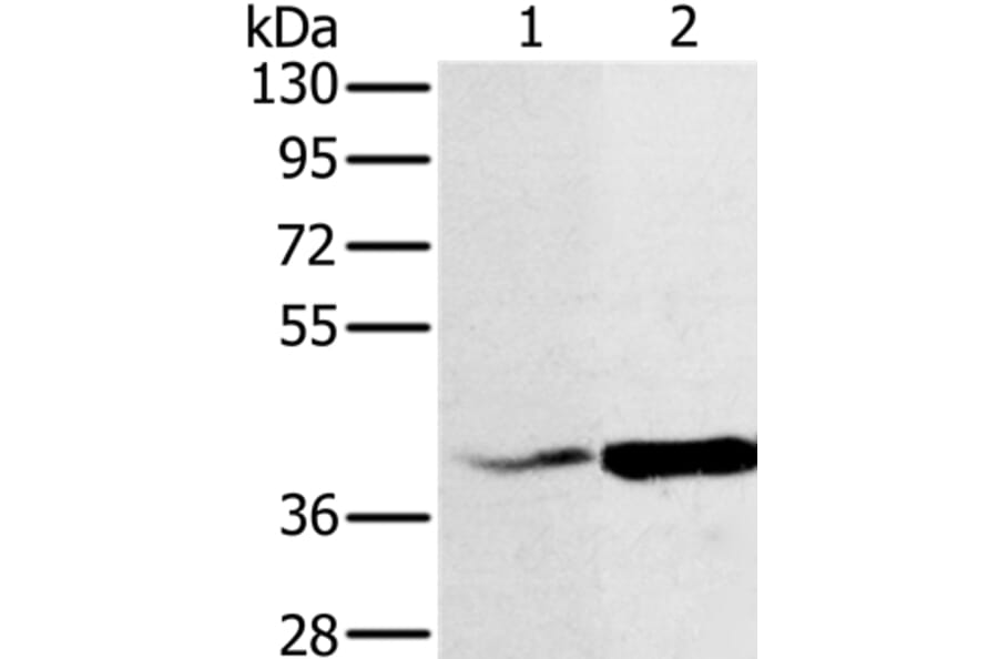 NDUFA10 Antibody from Signalway Antibody (36635) - Antibodies.com