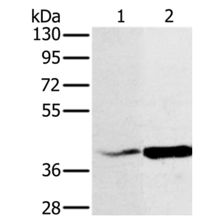 NDUFA10 Antibody from Signalway Antibody (36635) - Antibodies.com