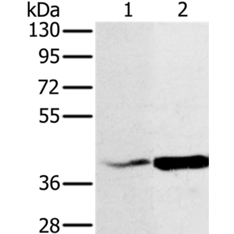 NDUFA10 Antibody from Signalway Antibody (36635) - Antibodies.com