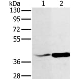 NDUFA10 Antibody from Signalway Antibody (36635) - Antibodies.com