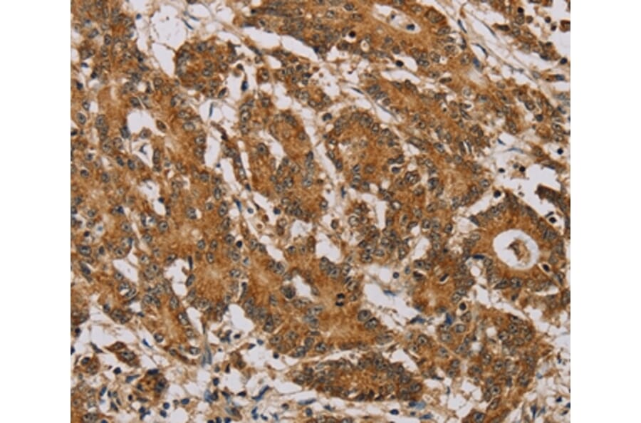 Immunohistochemistry - NDUFA10 Antibody from Signalway Antibody (36635) - Antibodies.com