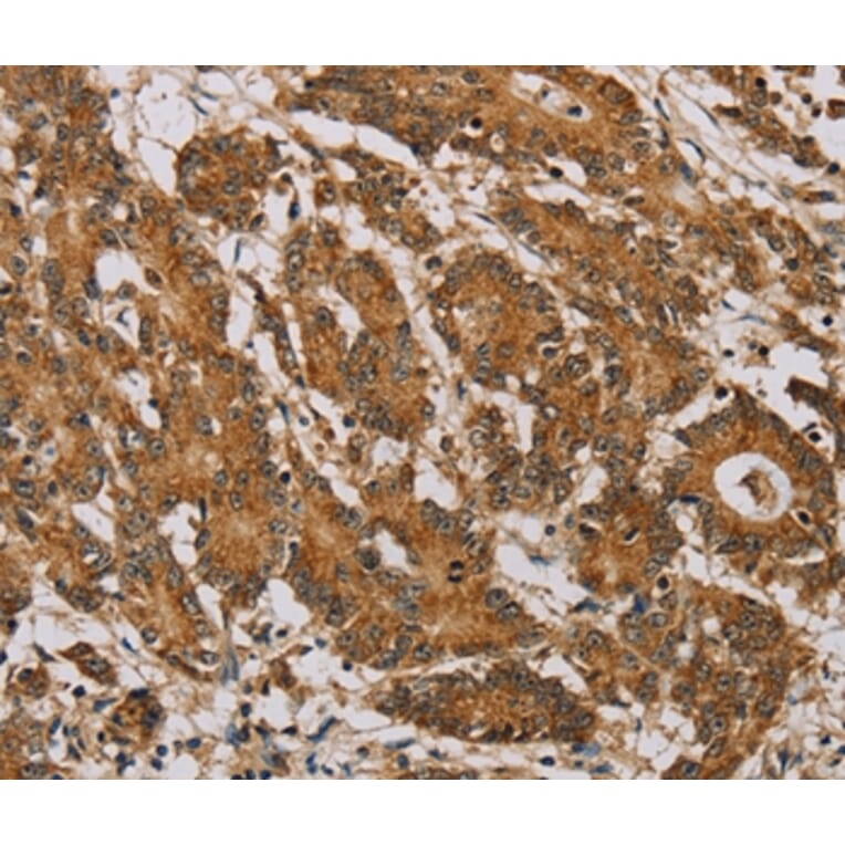 Immunohistochemistry - NDUFA10 Antibody from Signalway Antibody (36635) - Antibodies.com