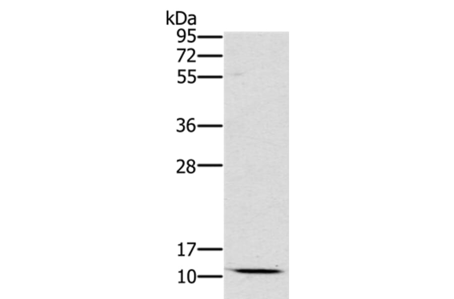 SCGB2A1 Antibody from Signalway Antibody (36684) - Antibodies.com