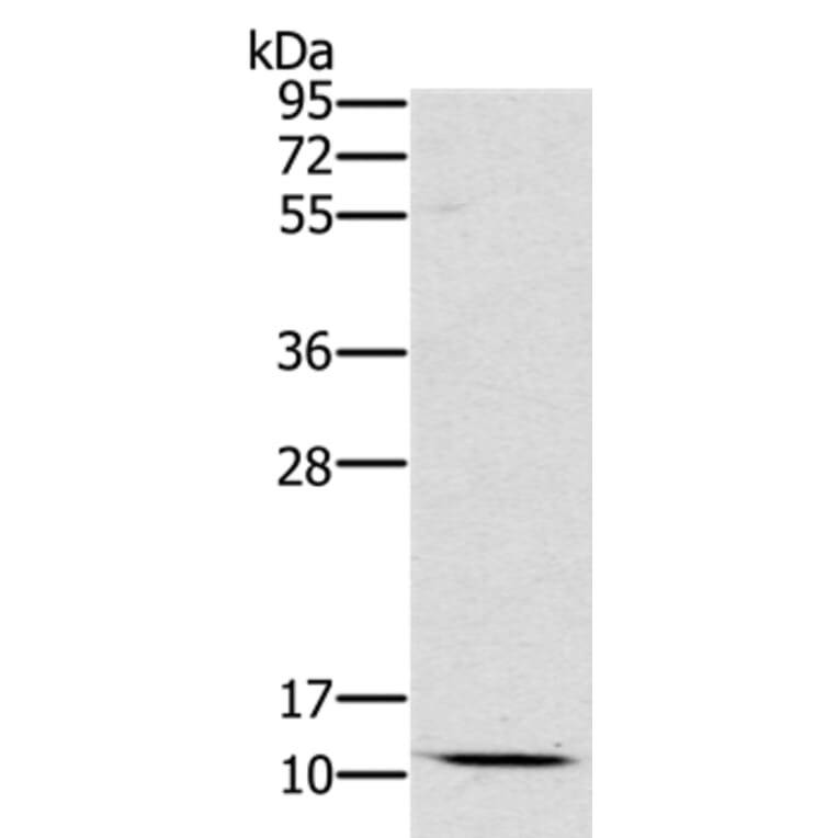SCGB2A1 Antibody from Signalway Antibody (36684) - Antibodies.com