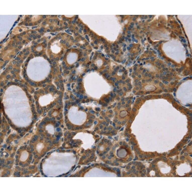Immunohistochemistry - SCGB2A1 Antibody from Signalway Antibody (36684) - Antibodies.com