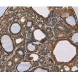 Immunohistochemistry - SCGB2A1 Antibody from Signalway Antibody (36684) - Antibodies.com