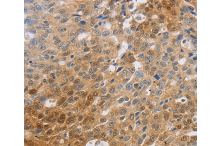 Immunohistochemistry - SLC16A7 Antibody from Signalway Antibody (36975) - Antibodies.com