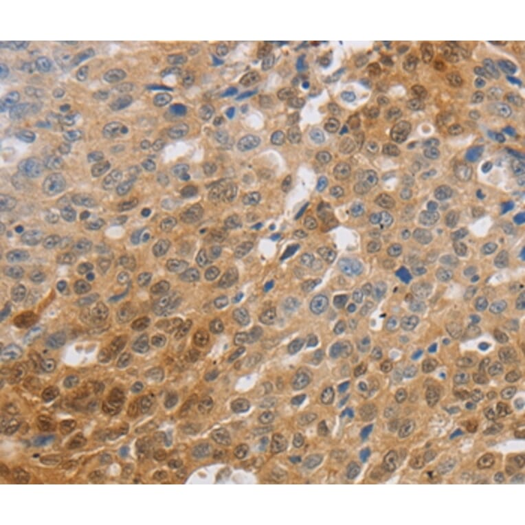 Immunohistochemistry - SLC16A7 Antibody from Signalway Antibody (36975) - Antibodies.com