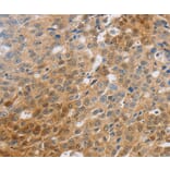 Immunohistochemistry - SLC16A7 Antibody from Signalway Antibody (36975) - Antibodies.com