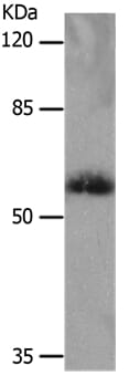 Gel: 10% SDS-PAGE Lysates (from left to right): Human fetal muscle tissue Amount of lysate: 40ug per lane Primary antibody: 1/1200 dilution Secondary antibody dilution: 1/8000 Exposure time: 10 minutes