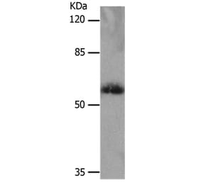 SLC16A4 Antibody from Signalway Antibody (36976) - Antibodies.com