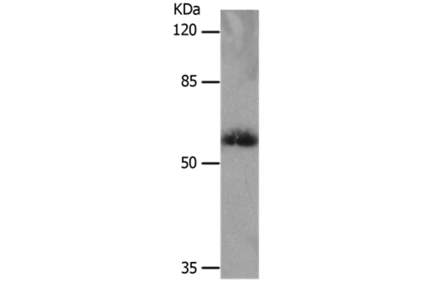 SLC16A4 Antibody from Signalway Antibody (36976) - Antibodies.com