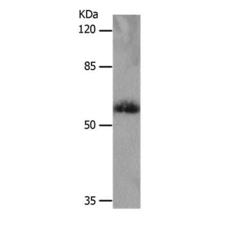 SLC16A4 Antibody from Signalway Antibody (36976) - Antibodies.com