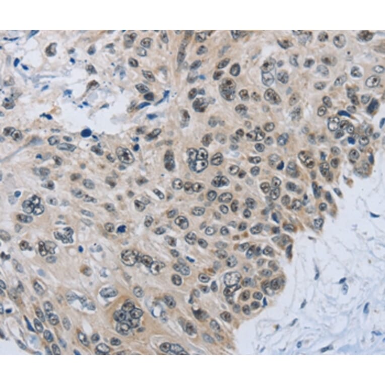 Immunohistochemistry - SLC16A4 Antibody from Signalway Antibody (36976) - Antibodies.com