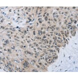 Immunohistochemistry - SLC16A4 Antibody from Signalway Antibody (36976) - Antibodies.com
