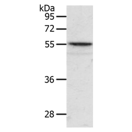 ANGPTL2 Antibody from Signalway Antibody (37101) - Antibodies.com