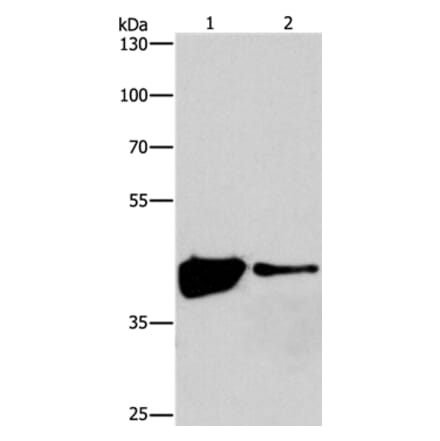 MAPK11 Antibody from Signalway Antibody (37131) - Antibodies.com